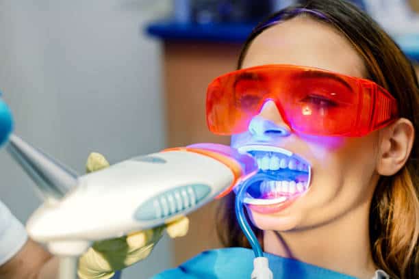 Simplifying Teeth Whitening: A Comprehensive Guide Berkshire