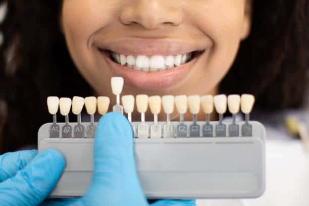 Laser Teeth Whitening: Exploring the Longevity of Your Brighter Smile Berkshire