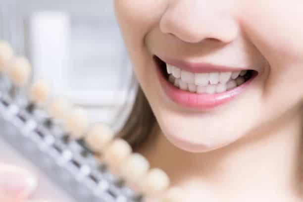 Teeth Whitening Kings Norton Berkshire