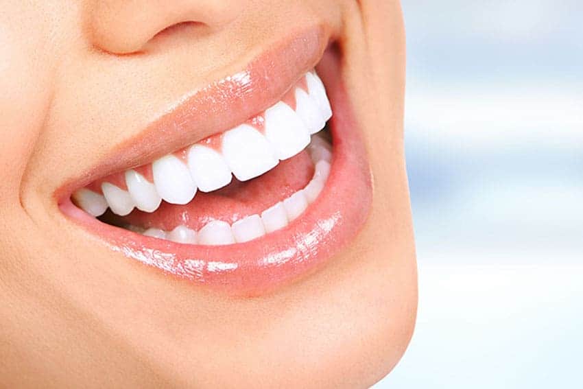 Teeth Whitening Abingdon Berkshire