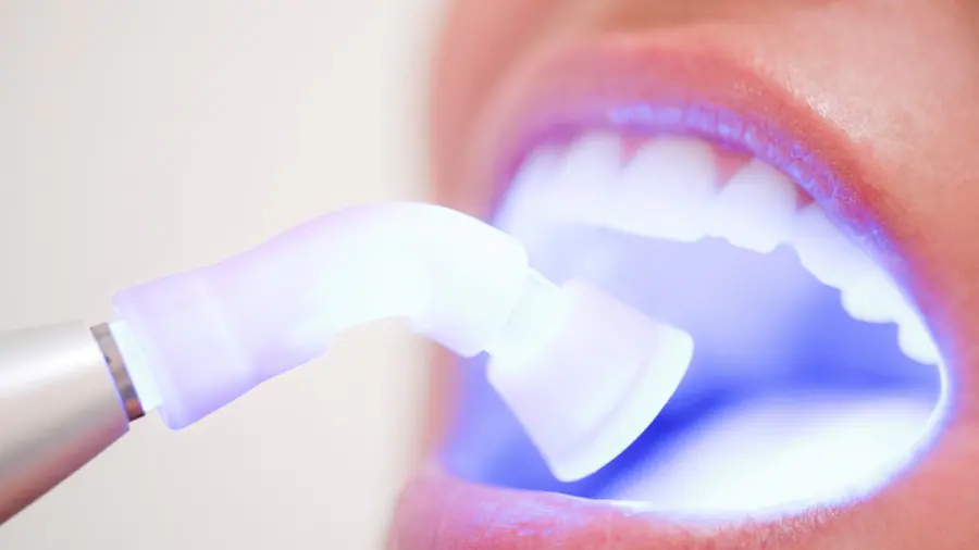 Teeth Whitening Aylesbury Berkshire